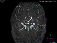 MRI