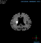 MRI