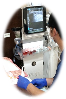 超音波エコー穿刺
