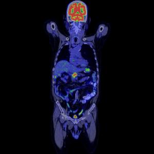 比較PET+CT