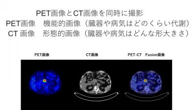 PET1
