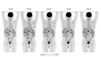PET2