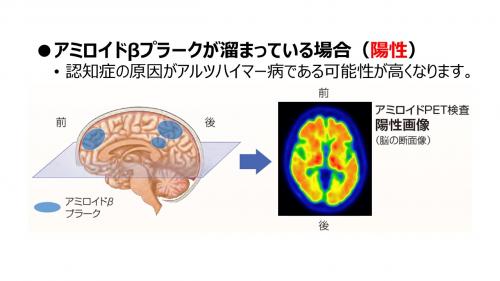 陽性